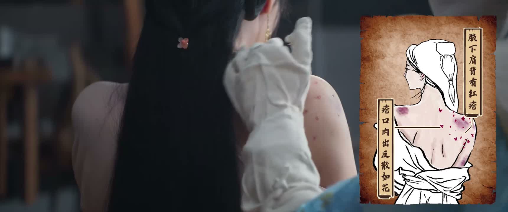 疮口肉出反散如花