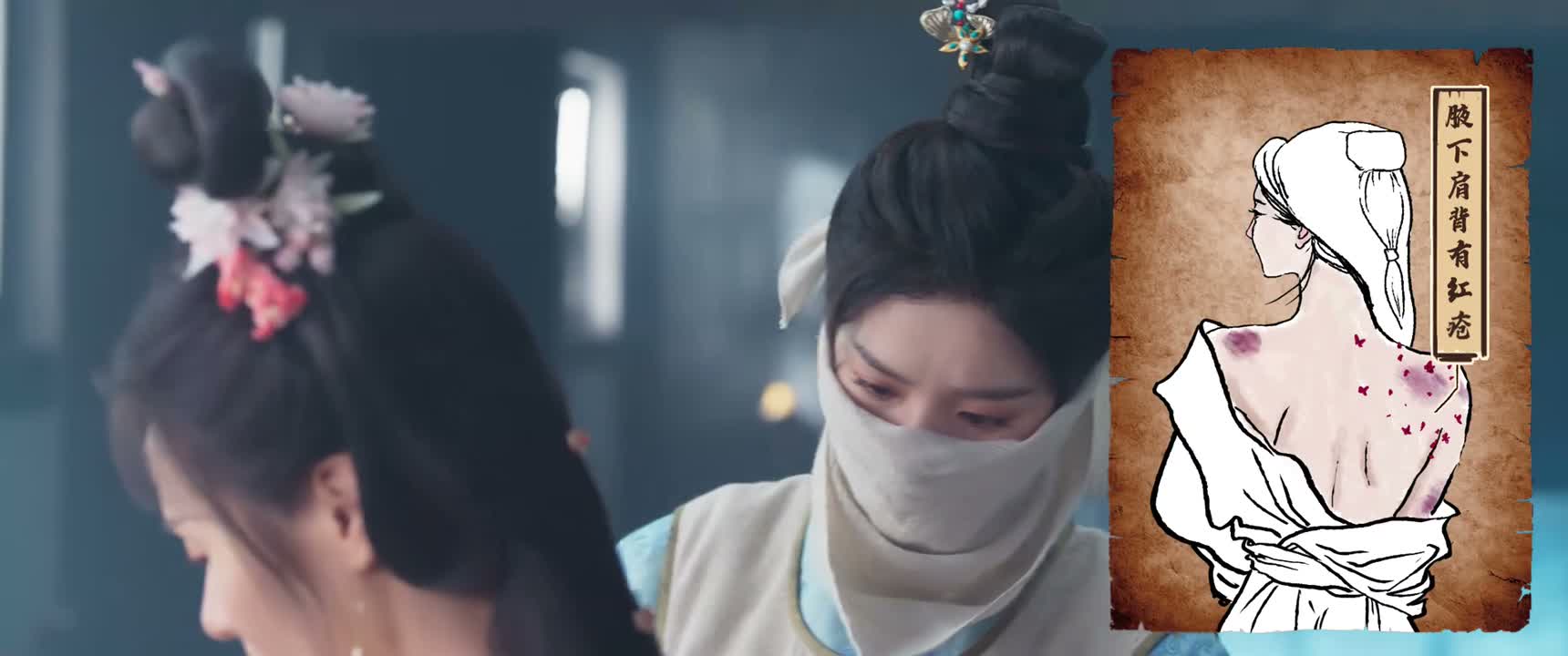 腋下肩背有红疮