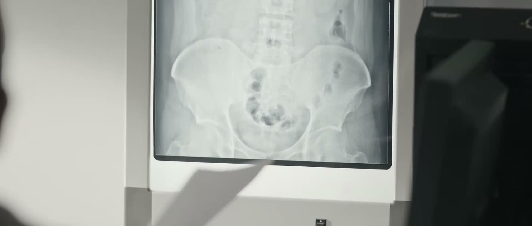 就是我要不了孩子