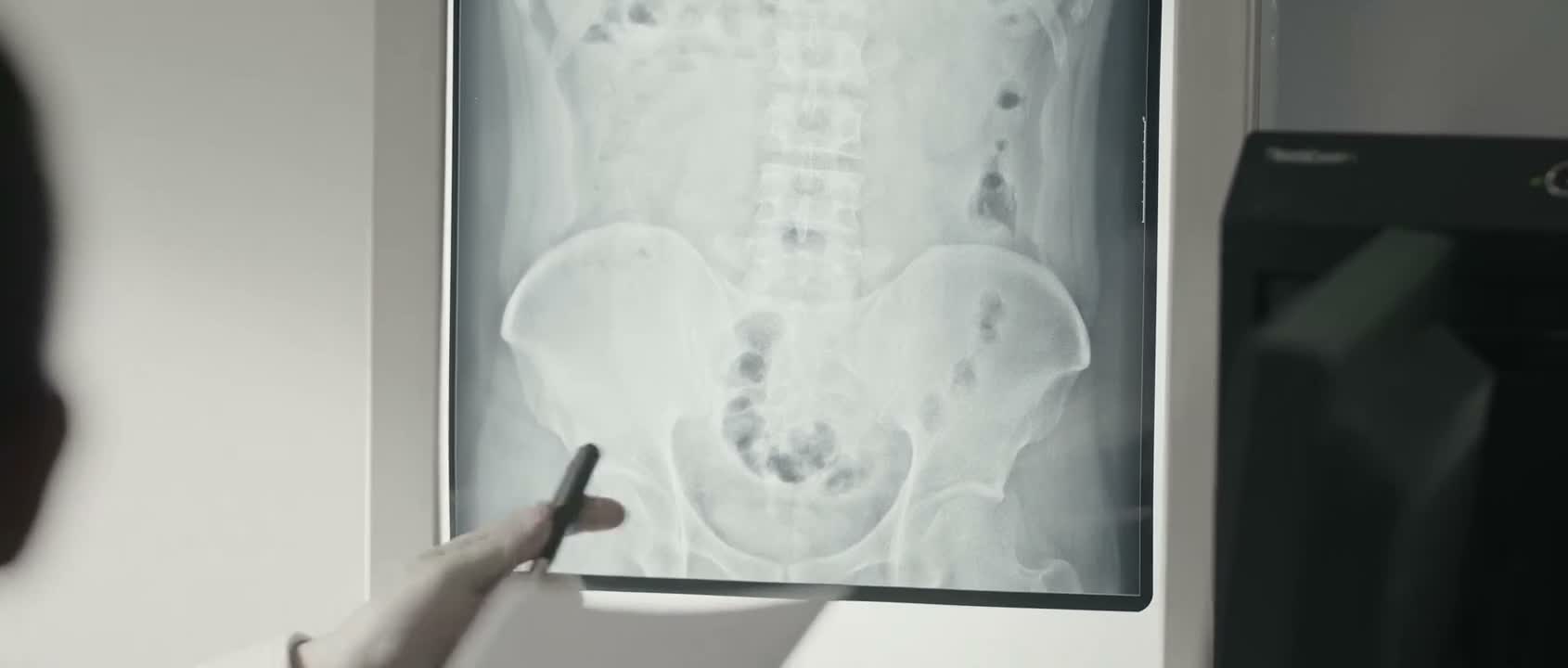 你的输精管是堵塞的
