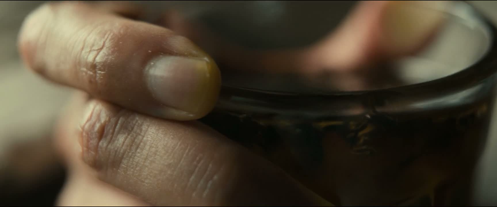 这种情况只能截肢