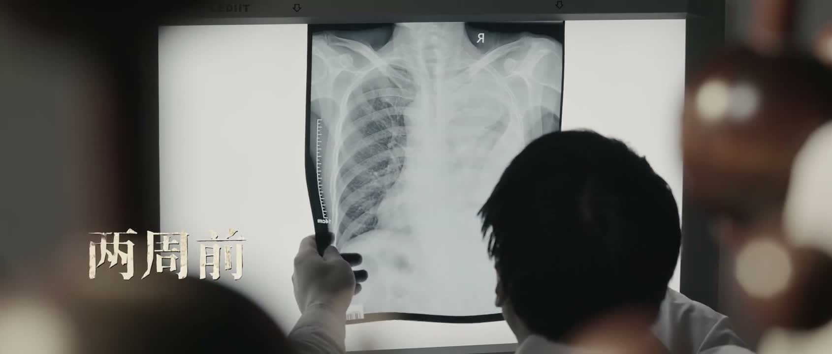 根据各项检查确诊